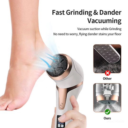 Electric Foot File Pedicure Machine Callus Remover Rechargeable Foot