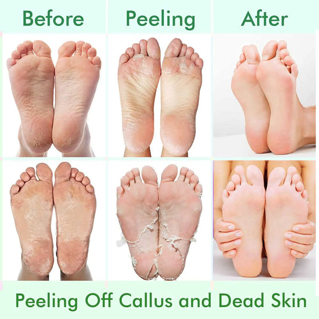 Foot Peel Mask,Exfoliator Peel Off Calluses Dead Skin Callus