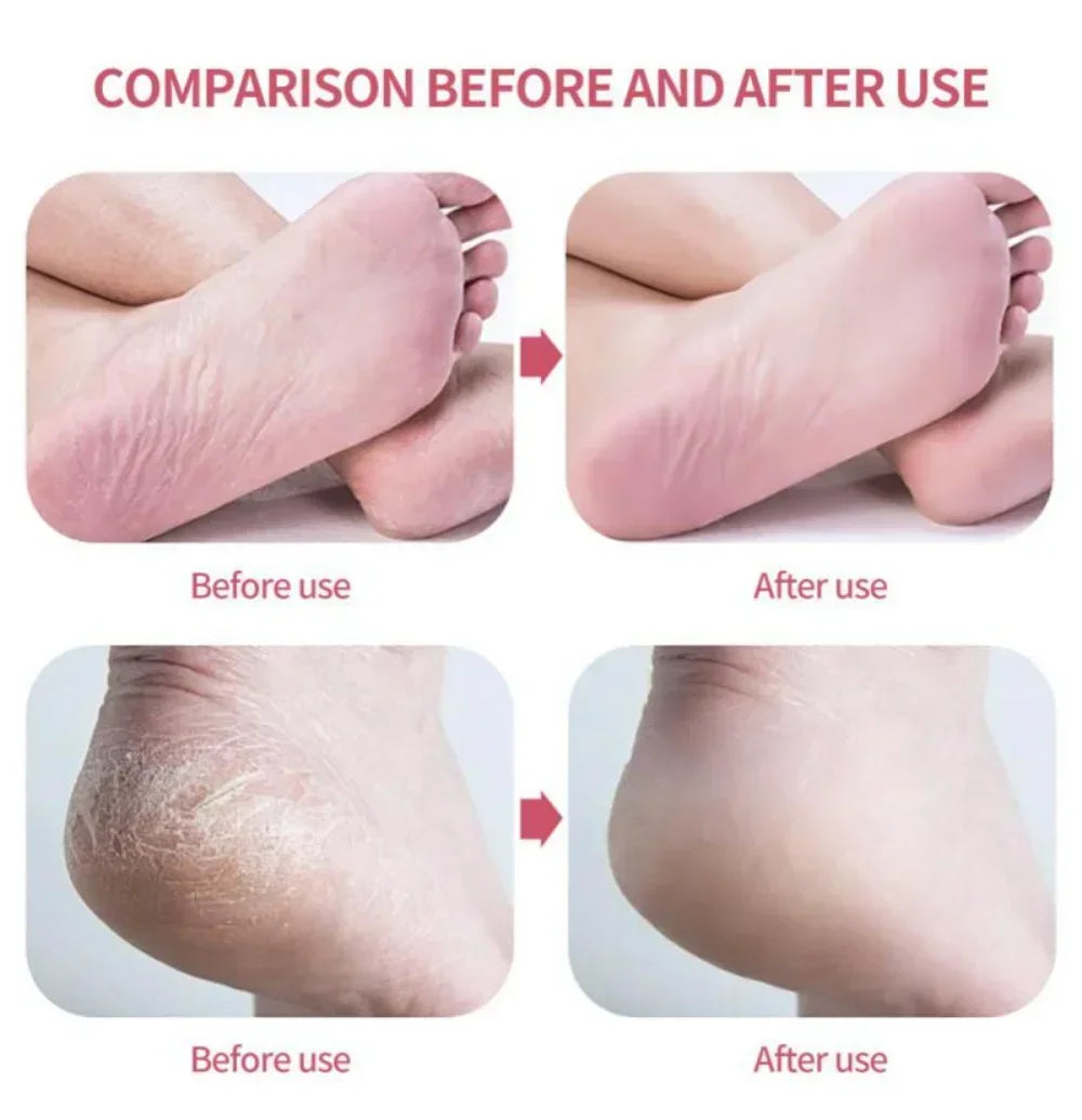 Nano Glass Foot Grinder Removing Dead Skin Calluses Heel Grinding