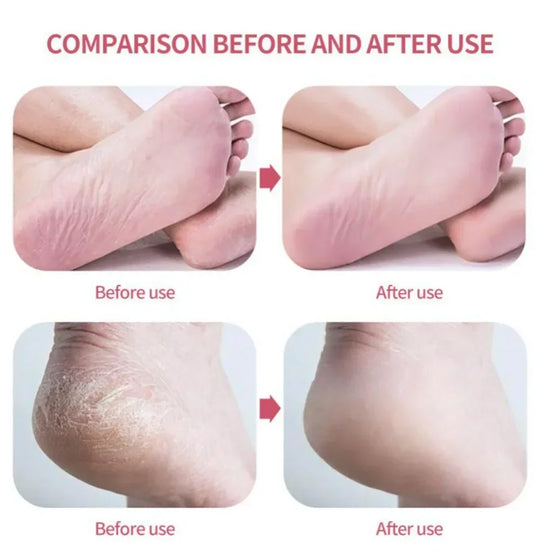 Nano Glass Foot Grinder Removing Dead Skin Calluses Heel Grinding