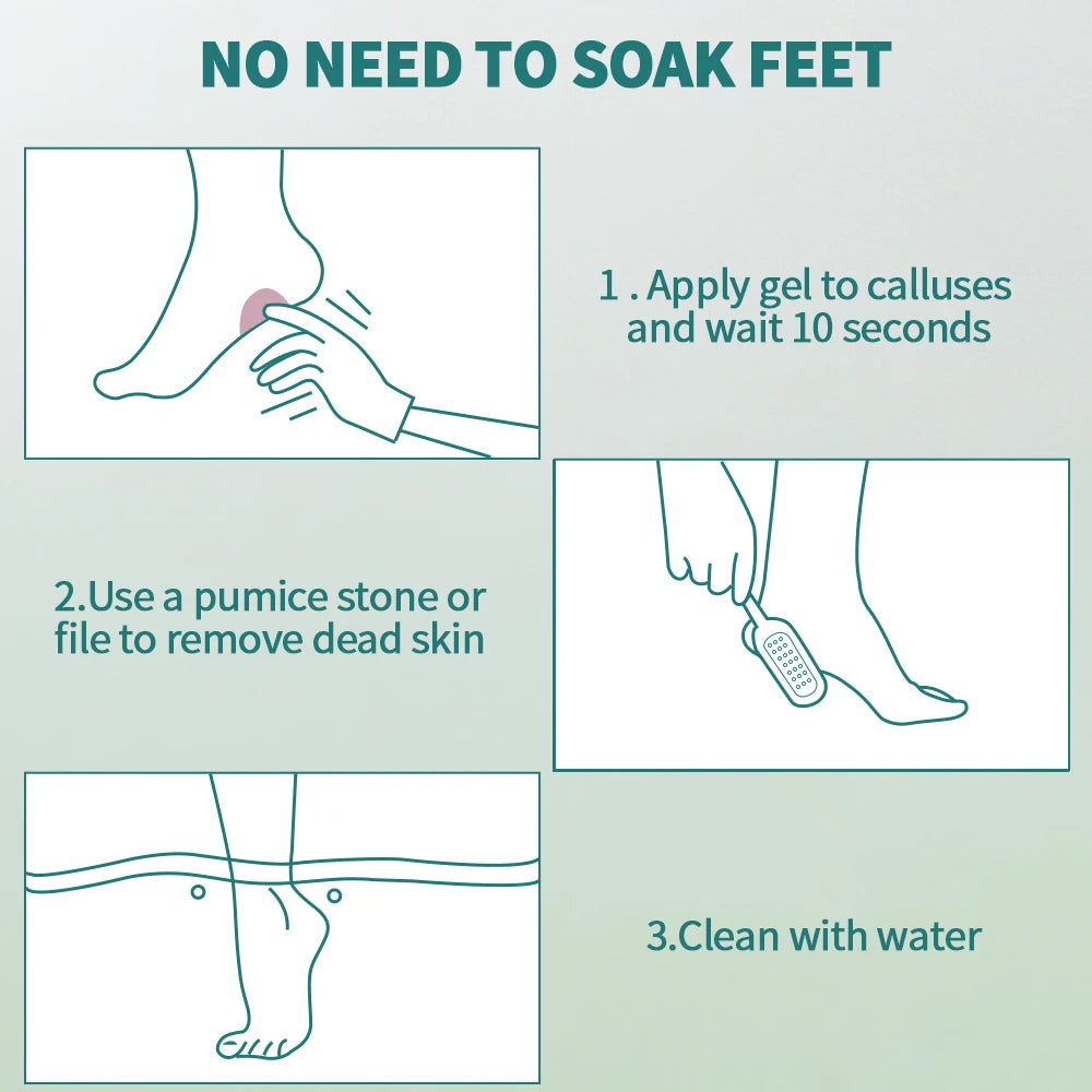 NAILPRO Extra Strength Callus Remover for Feet and Foot File Kit