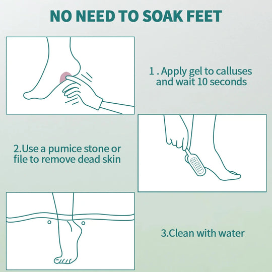 NAILPRO Extra Strength Callus Remover for Feet and Foot File Kit