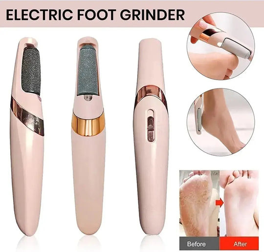 Electric Callus Remover for Feet, Rechargeable Foot File Pedicure