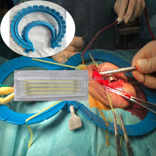 Surgical Abdominal Retractor Rectal Retractor Ring Lonestar Retractor